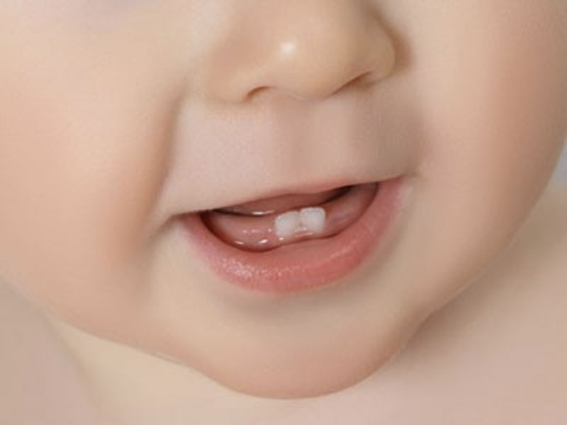 Meilleur gel dentaire bébé le plus efficace: guide comparatif 2023